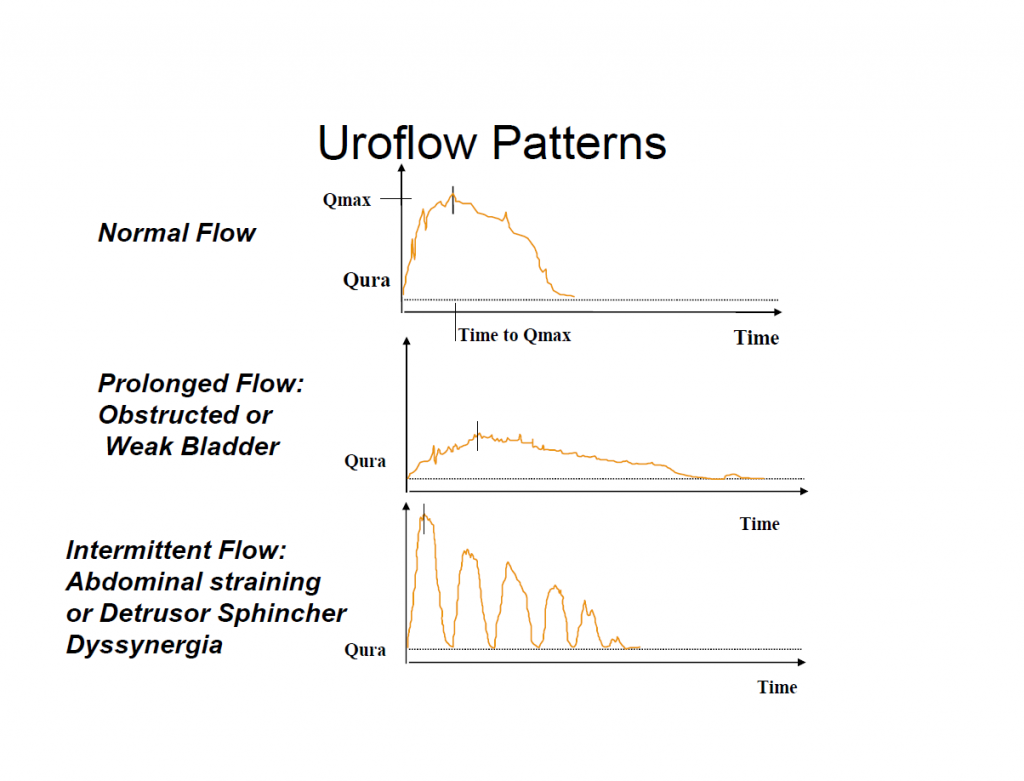 What Is Urine Flow Rate Test at Aaron Roberson blog